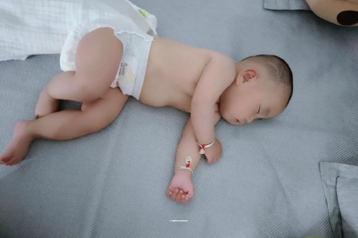 丹东六个月宝宝眼睛散光